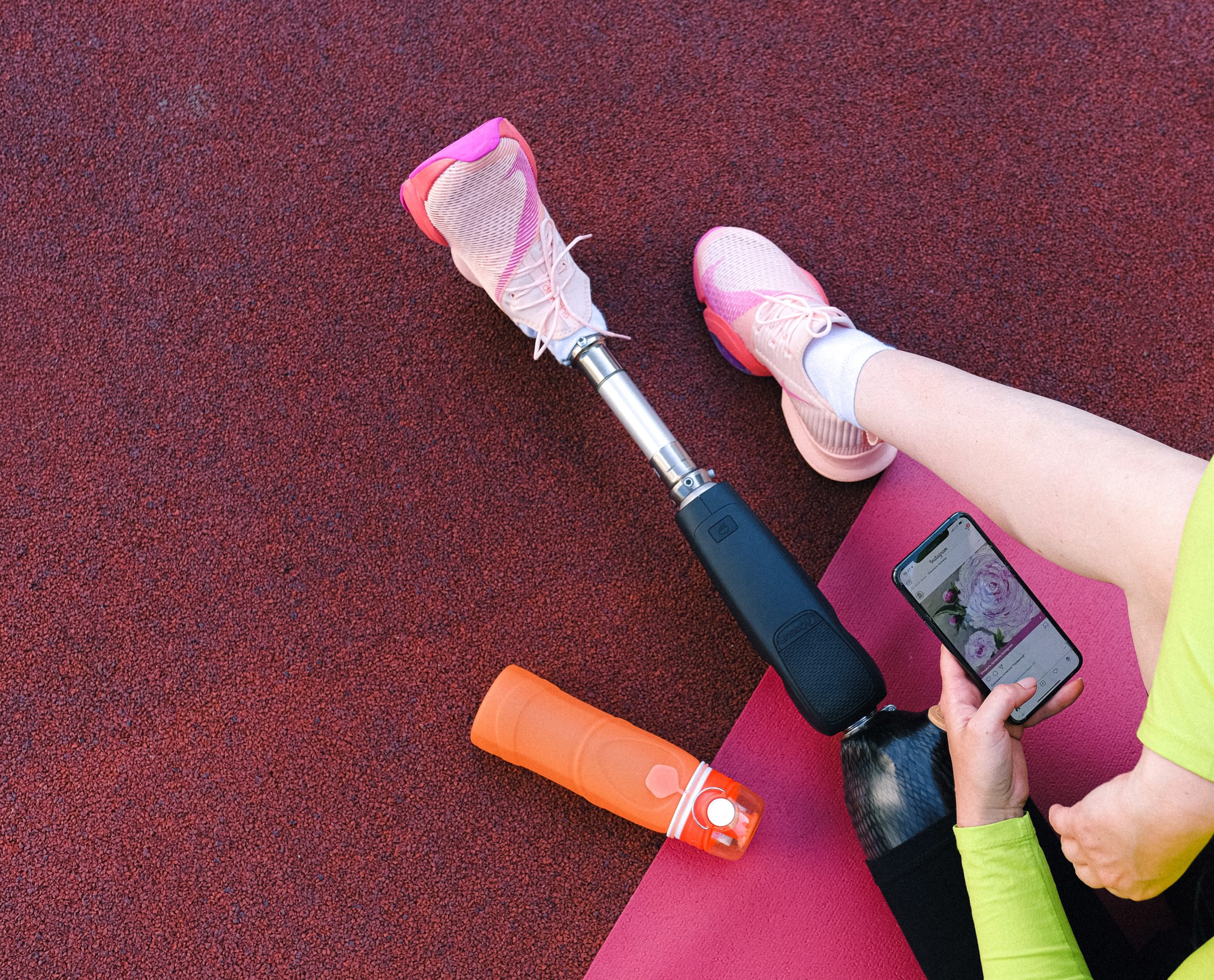 Health Insurance Is A Nightmare – Why The Prosthetics Series Is Delayed